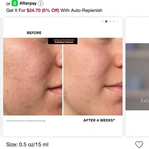 Kate Somerville ExfoliKate New - Picture 8 of 11